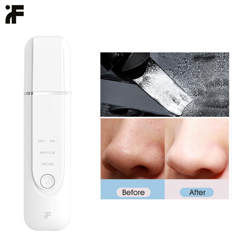Аппарат для ультразвуковой чистки лица InFace MS7100 Белый - фото 4